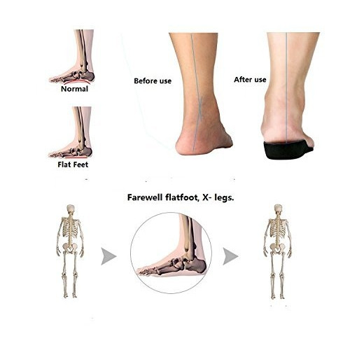 Orthopedic foot-care insoles - Image 16
